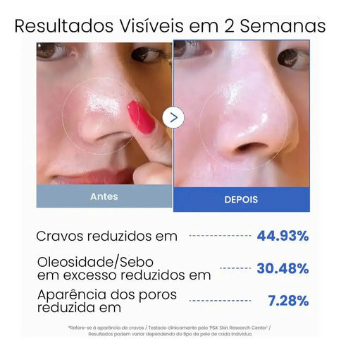 Medicube Zero Pore Pad 70 Pads Aha Bha Control Grasa Normal Noche