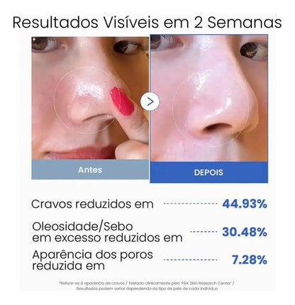 Medicube Zero Pore Pad 70 Pads Aha Bha Control Grasa Normal Noche