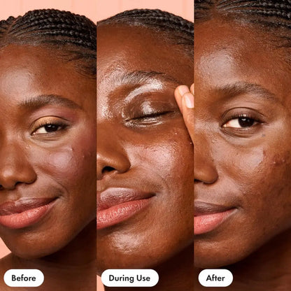 Hero Cosmetics Bálsamo Limpiador 65 Ml Piel Sensible Todo Tipo De Piel Día/noche