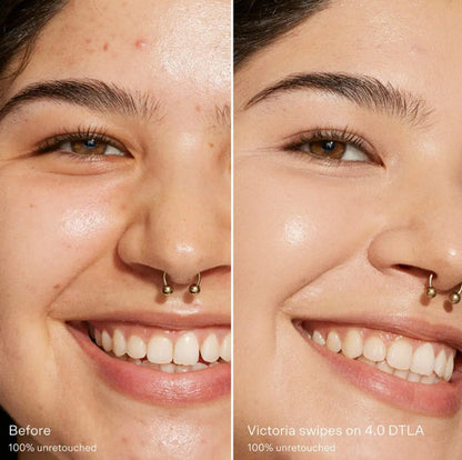 Tower 28 Corrector Swipe Serum 4.0 Dtla - 4.0 Dtla - Claro Con Matices Medio Fríos