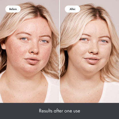 Hero Cosmetics Crema Corrector Verde Cobertura Ligera