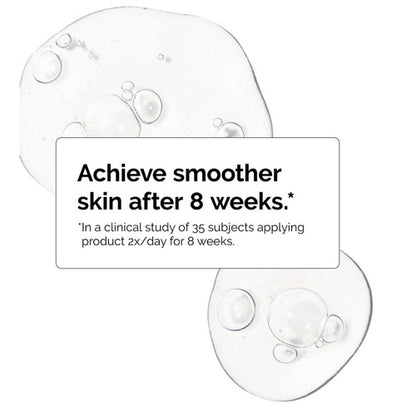 The Ordinary Niacinamide 10% + Zinc 1% Serúm Facial Todo Tipo De Piel Día/noche