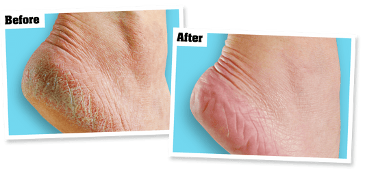 O'Keeffe's Healthy Feet Cream Crema Reparadora Para Pies 2.7oz